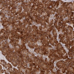 ARHGEF10L Antibody, Novus Biologicals 25 &mu;L; Unlabeled:Antibodies, Polyclonal
